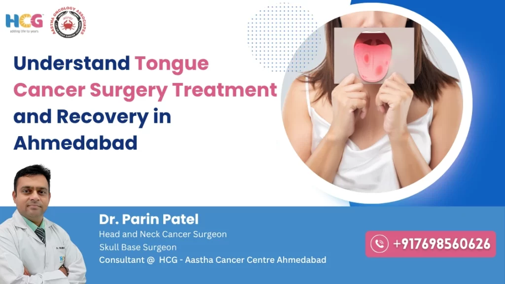 Understand Tongue Cancer Surgery