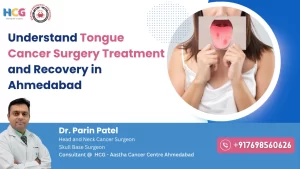 Understand Tongue Cancer Surgery