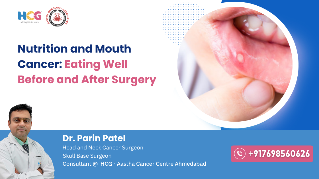 Clinical care related to nutrition and mouth cancer: eating well before and after surgery