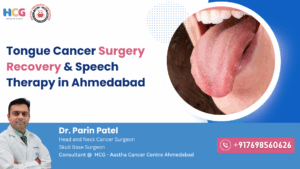Tongue Cancer Surgery Recovery