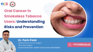 Oral Cancer in Smokeless Tobbaco Users