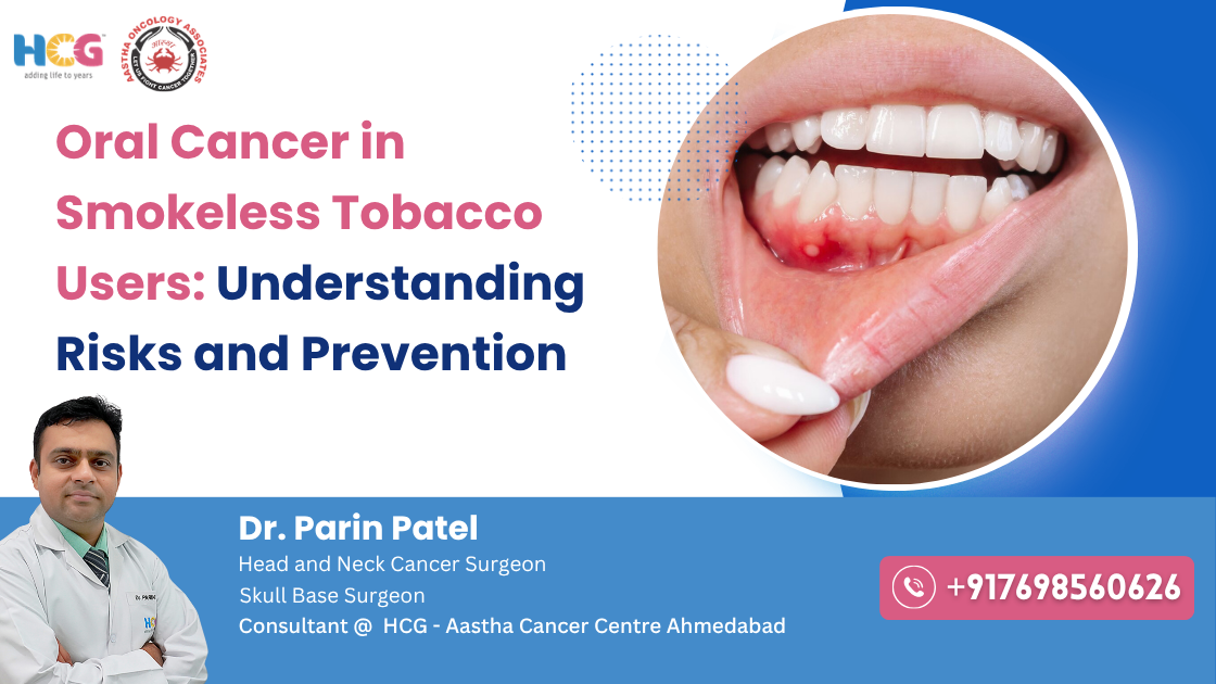 Clinical care related to oral cancer in smokeless tobacco users: understanding risks and prevention