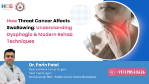 Throat Cancer Affects Swallowing