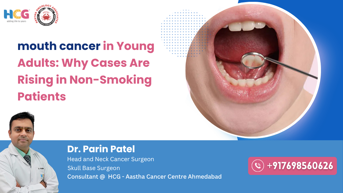 Clinical care related to mouth cancer in young adults: why cases are rising in non-smoking patients