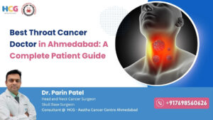 Best Throat Cancer Doctor in Ahmedabad: A Complete Patient Guide