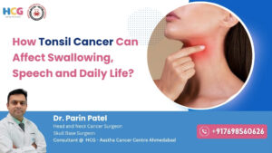 Tonsil cancer affecting swallowing, speech and daily life